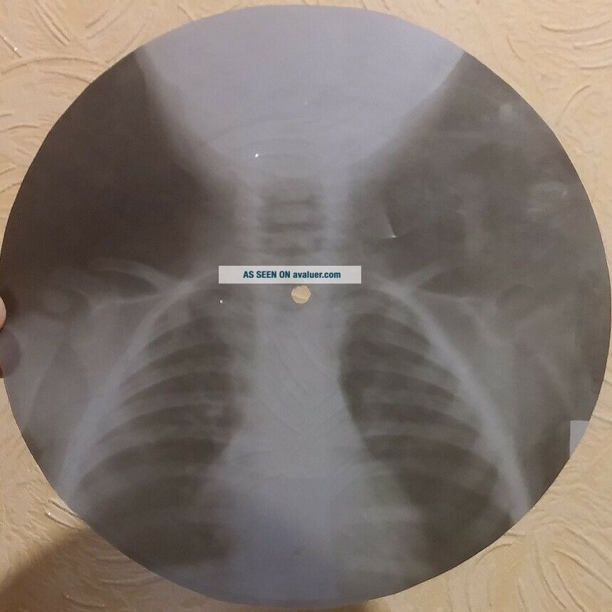 GRATEFUL DEAD - RAIN AND SNOW - USSR GEORGIAN X - RAY ROENTGEN BONES SKULL RECORD