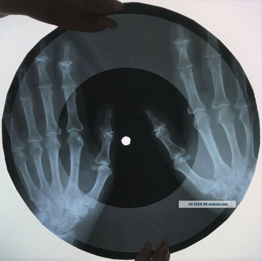 Simon and Garfunkel - Homeward Bound X - RAY USSR ROENTGEN Bones Records