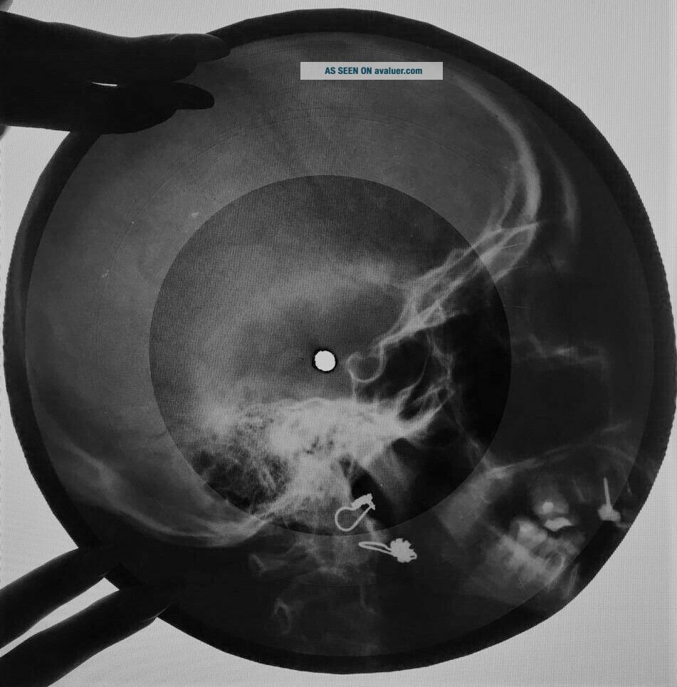 Beatles - And I Love Her X - RAY USSR ROENTGEN Bones Records SKULL